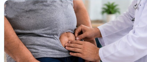 Hernia Repair at Dr. Javed Khan's surgical clinic
